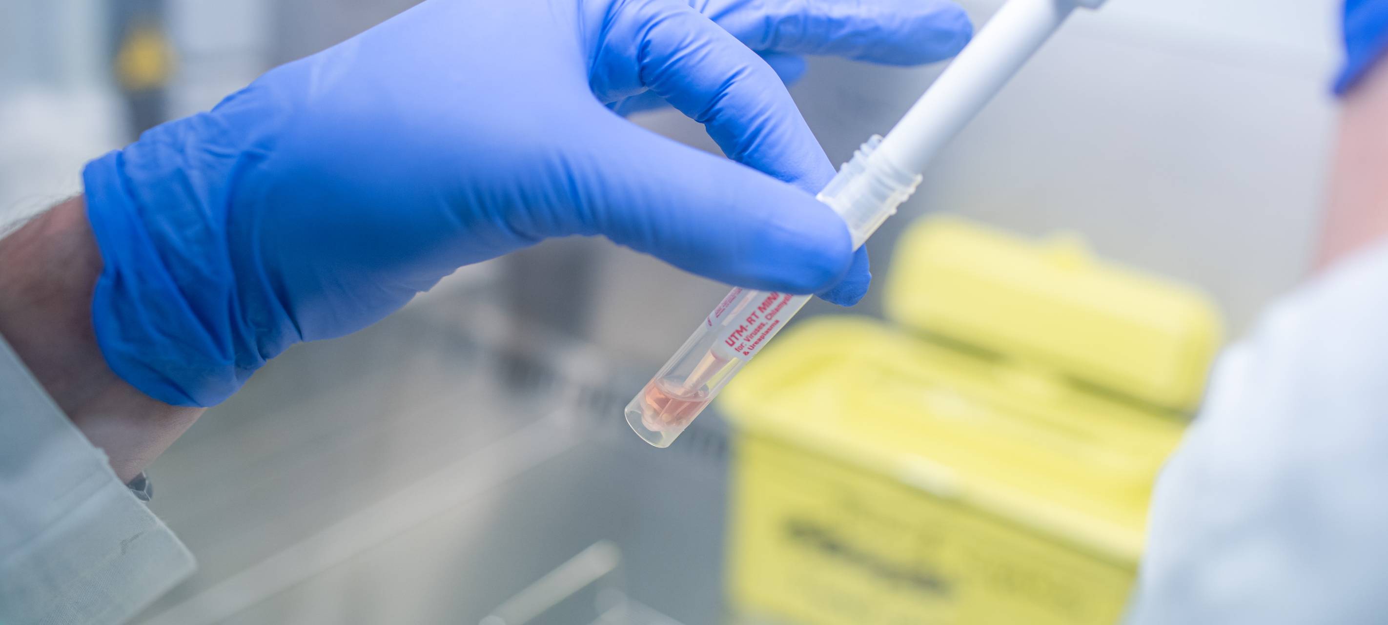 Inzidenz bleibt unter 100