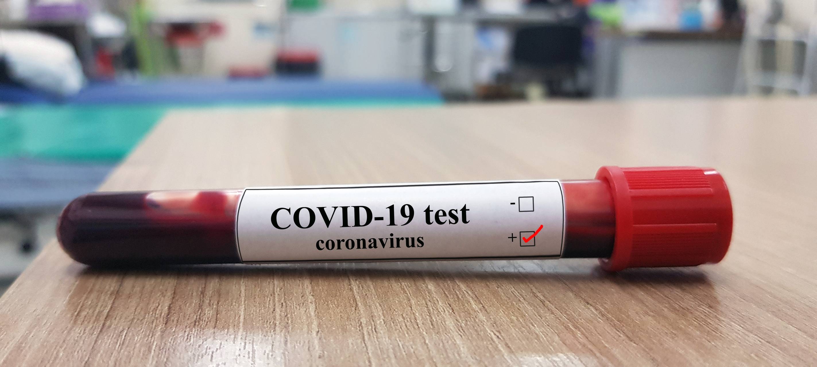 Corona Virus Bluttest