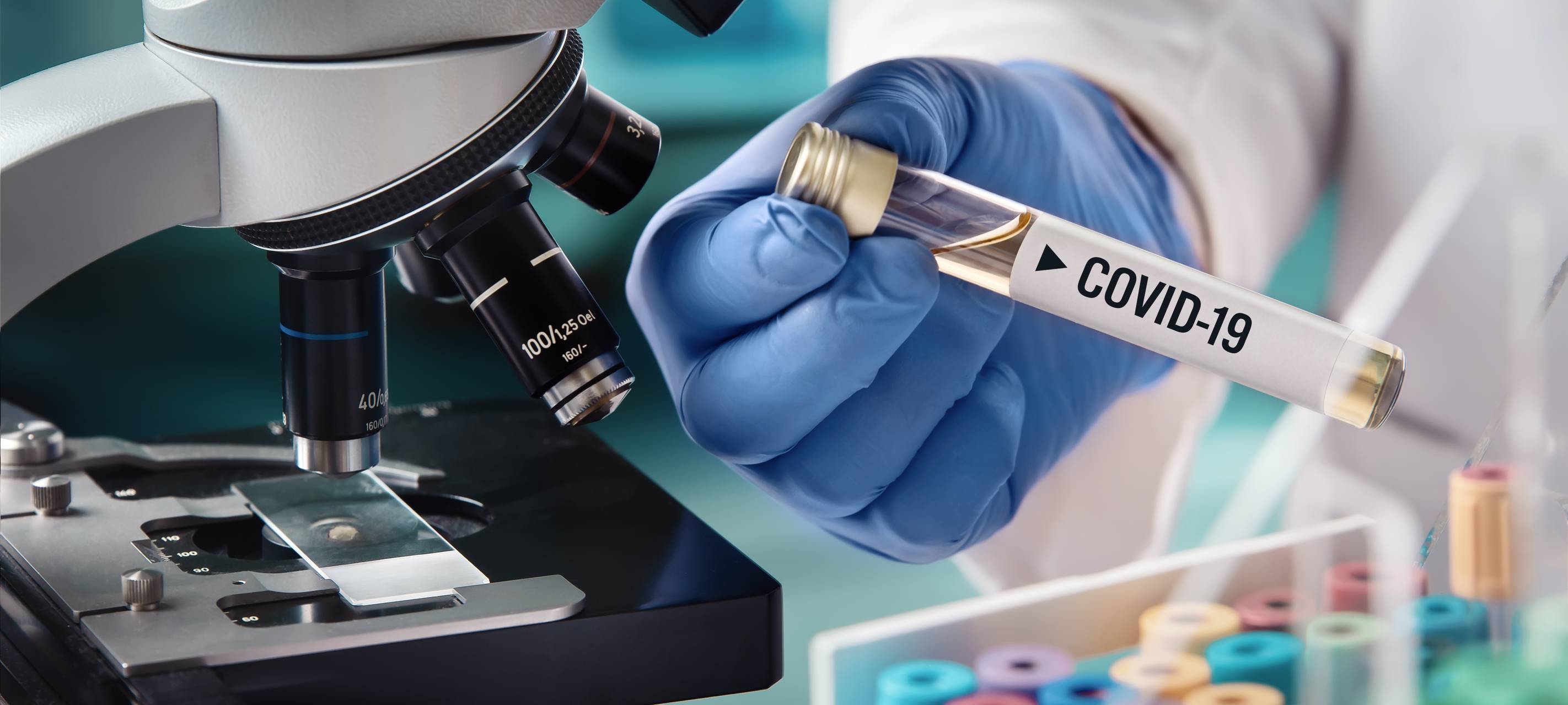 Microbiologe mit einer biologischen Probe, die mit dem Coronavirus kontaminiert ist. Auf der Probe ist das Etikett Covid-19 zu erkennen.