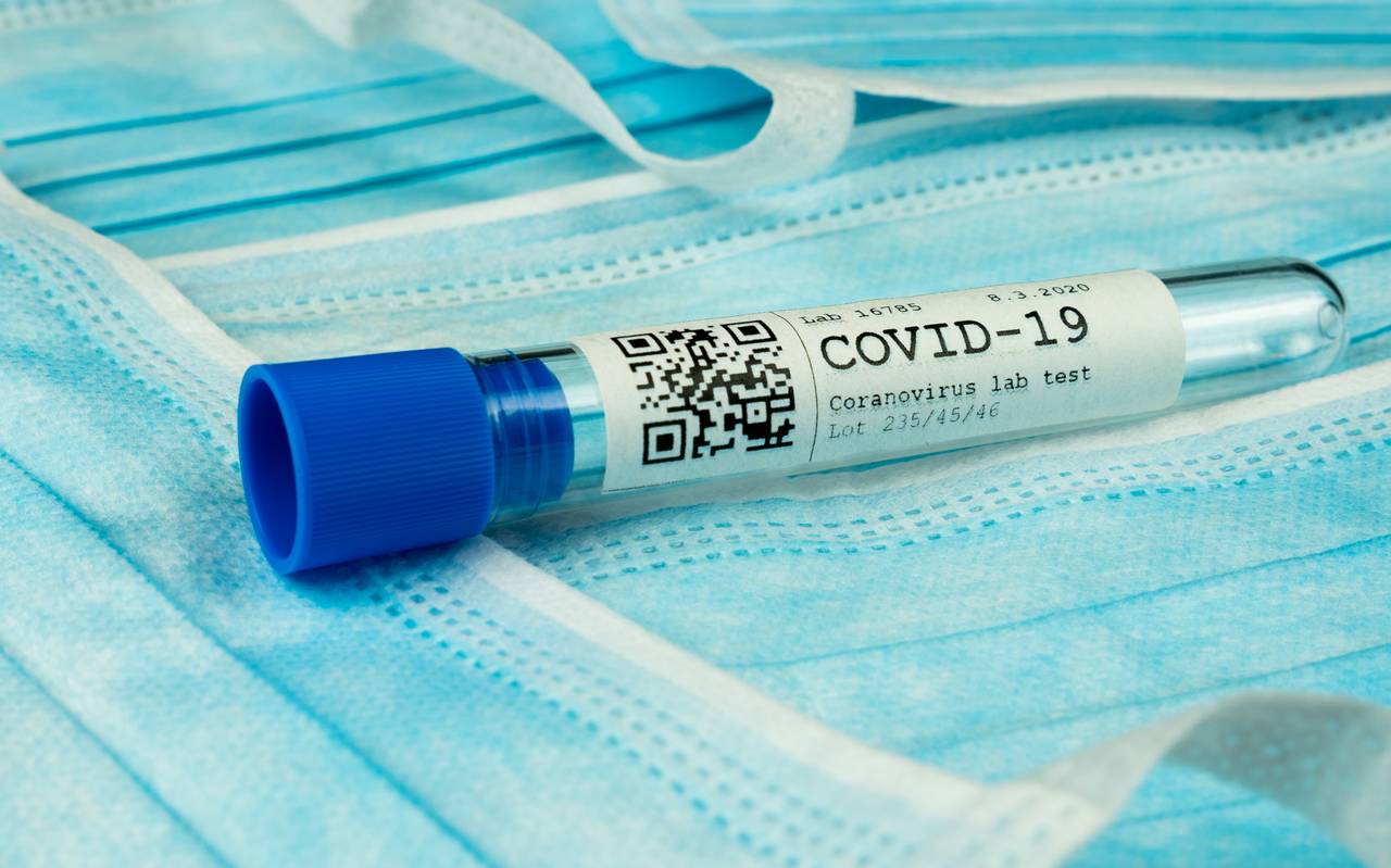Ein Labortest-Röhrchen mit der Beschriftung COVID-19 Coronavirus Labortest liegt auf Schutzmasken.