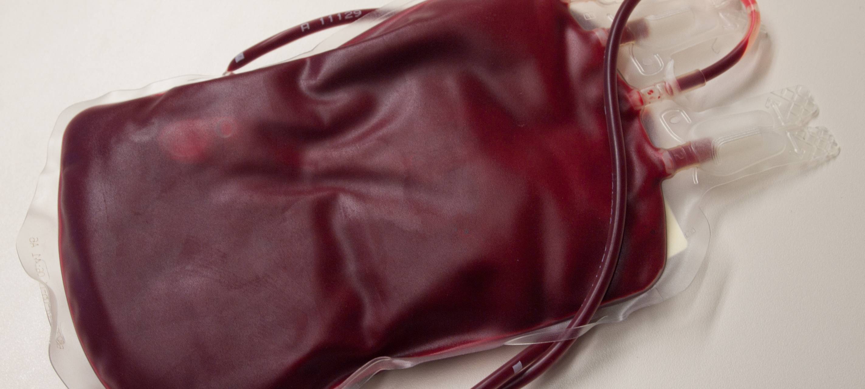 Zahl der Blutspenden eingebrochen