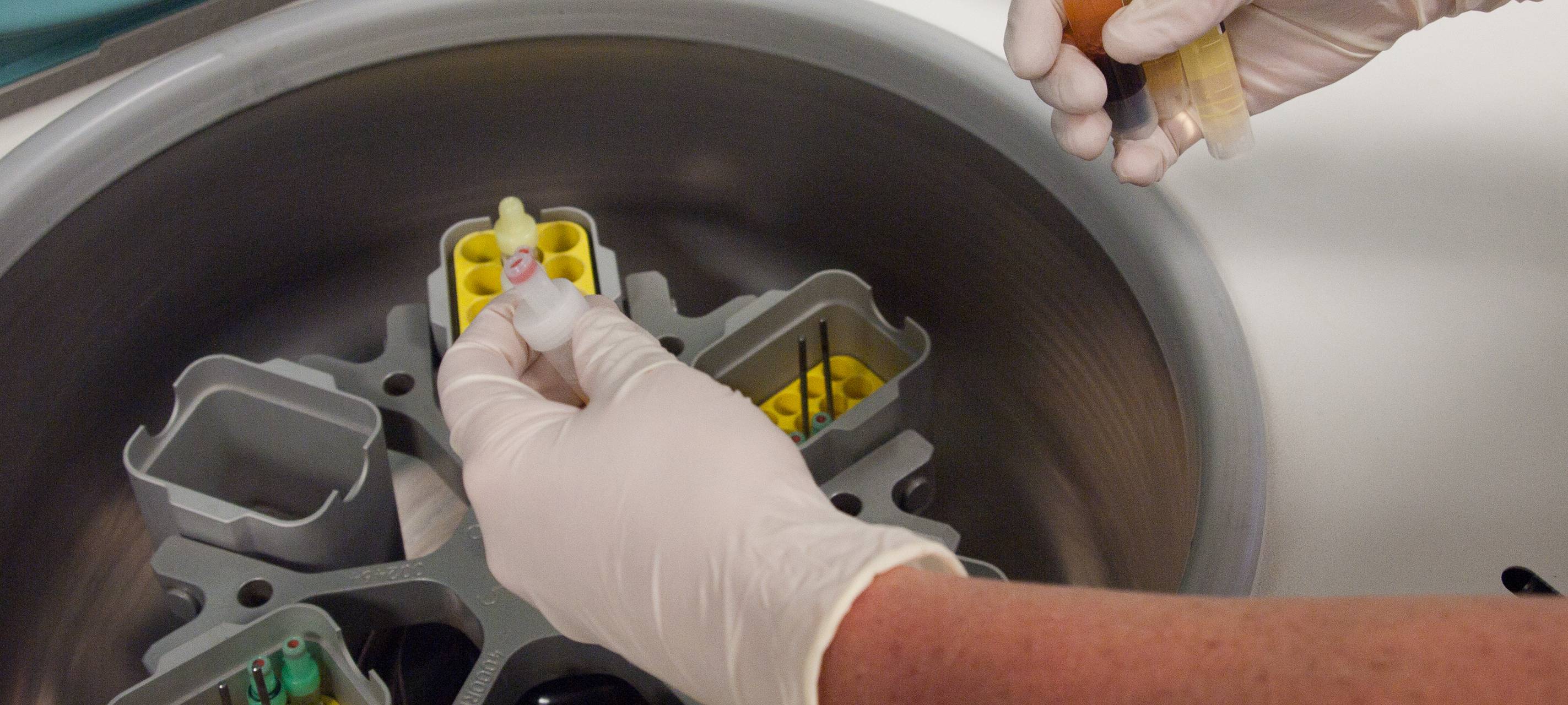 Omikron: Stadt Essen gibt Entwarnung