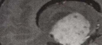 Schon mehr als 80.000 Euro für Ida