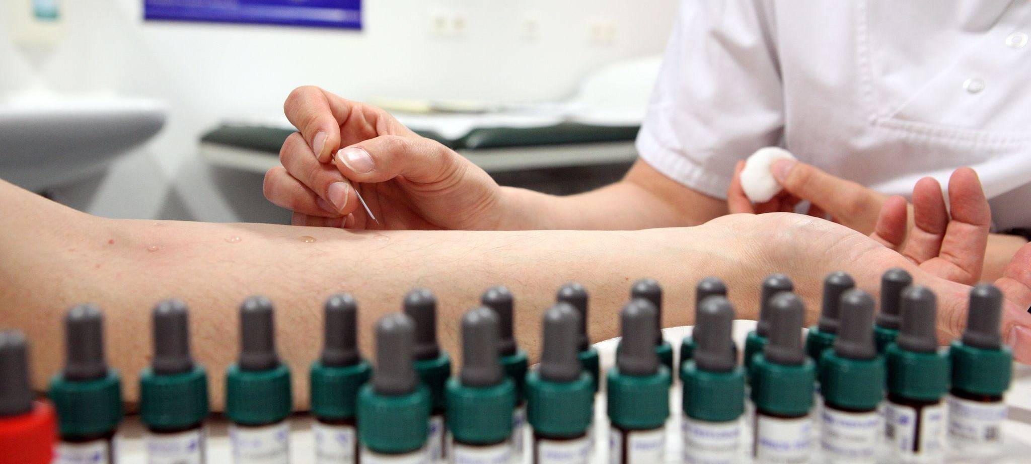 Allergietest im UKE in Hamburg