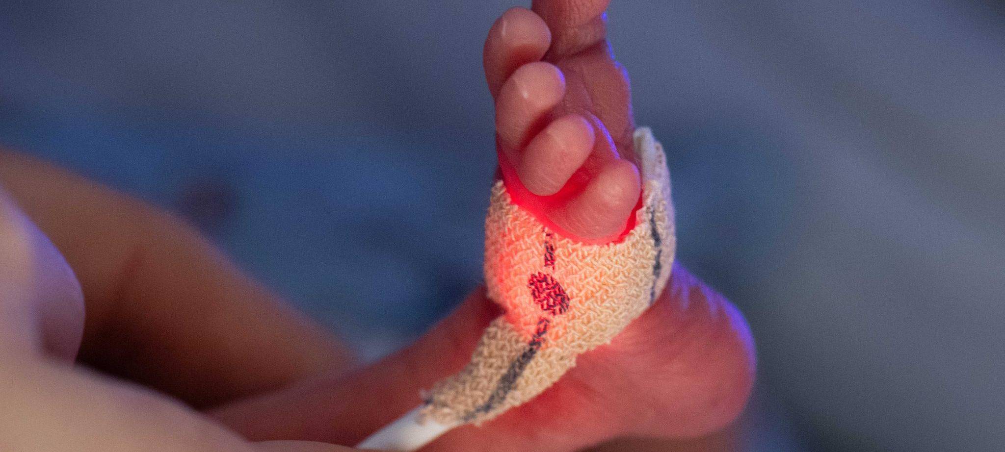 Darmkeim-Infektionen in Kinderklinik: Frühchen gestorben